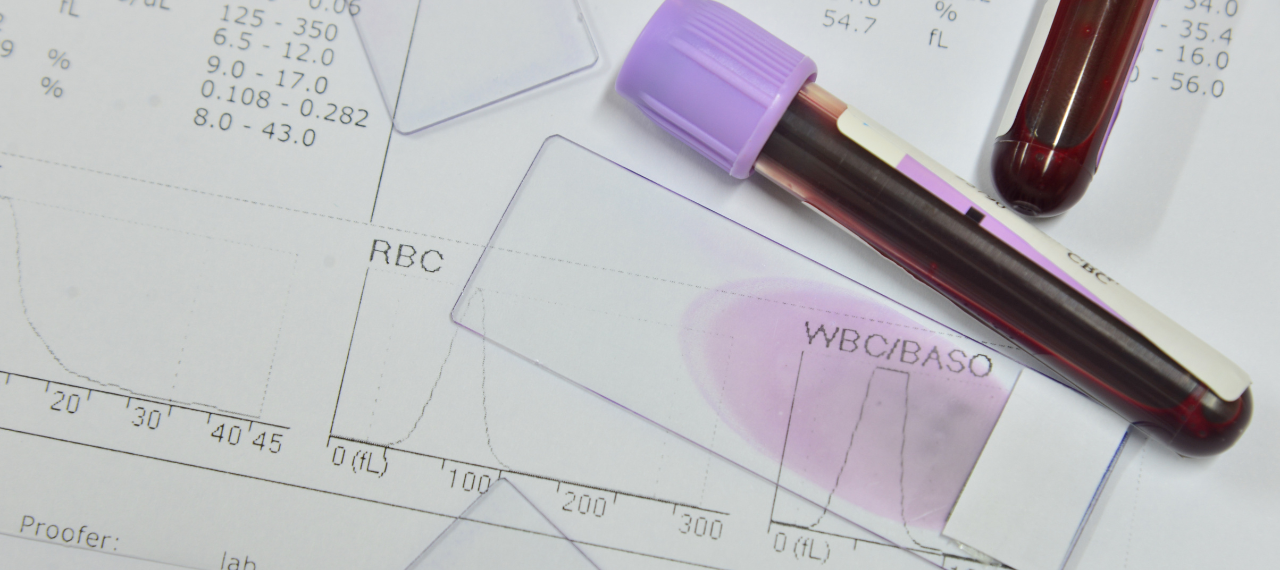 Interpretação de Hemograma